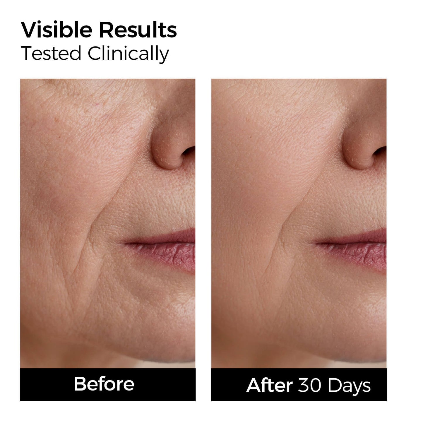 YOOJ™ Hyaluronic Acid