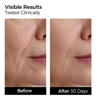 YOOJ™ Hyaluronic Acid