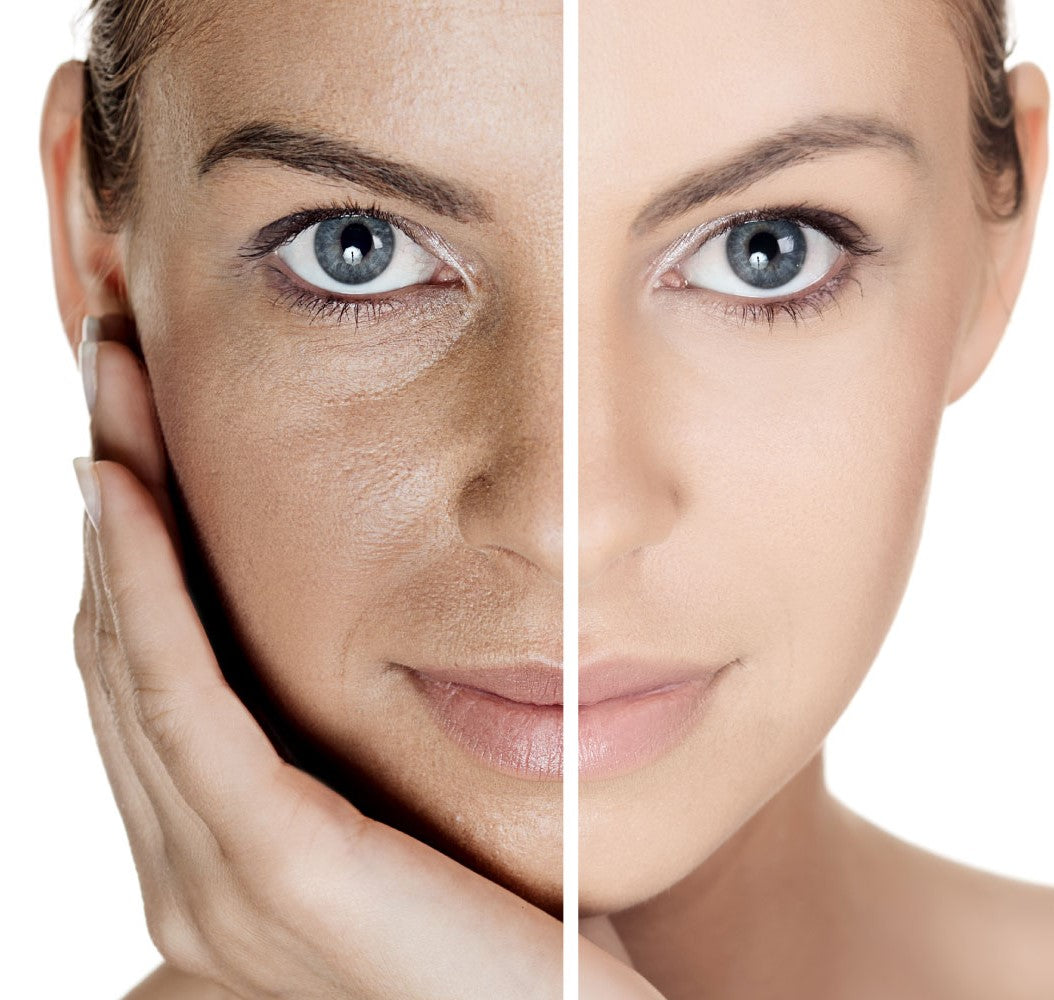 YOOJ™ Hyaluronic Acid